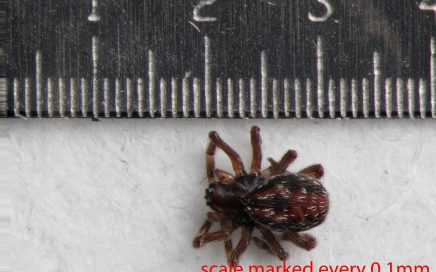 Arthropoda; Arachnida; Araneae