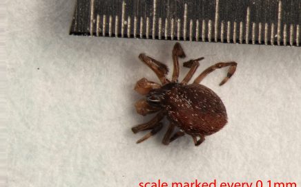 Arthropoda; Arachnida; Araneae